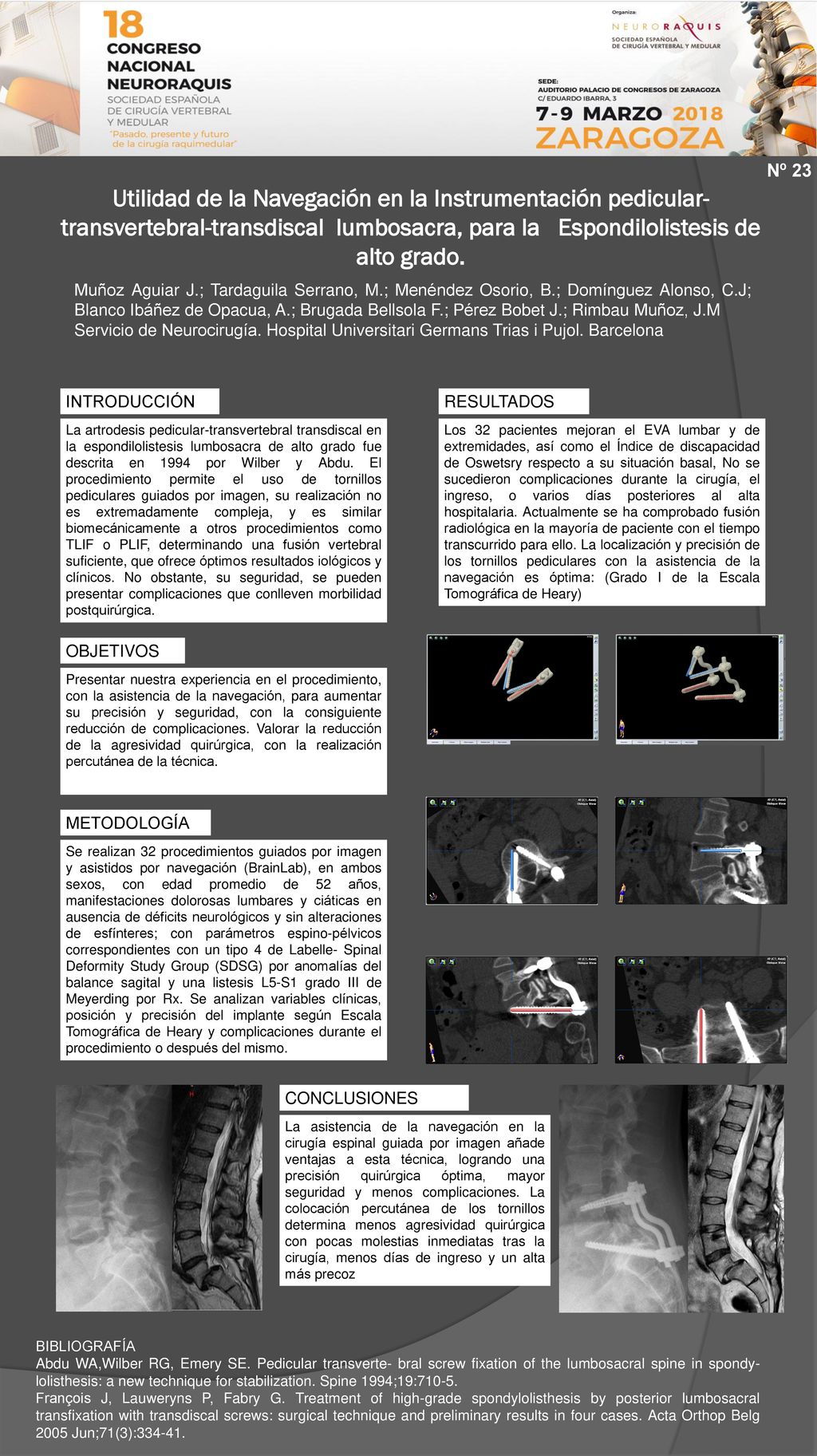 Nº 23 Utilidad de la Navegación en la Instrumentación pedicular-transvertebral-transdiscal lumbosacra, para la Espondilolistesis de alto grado.