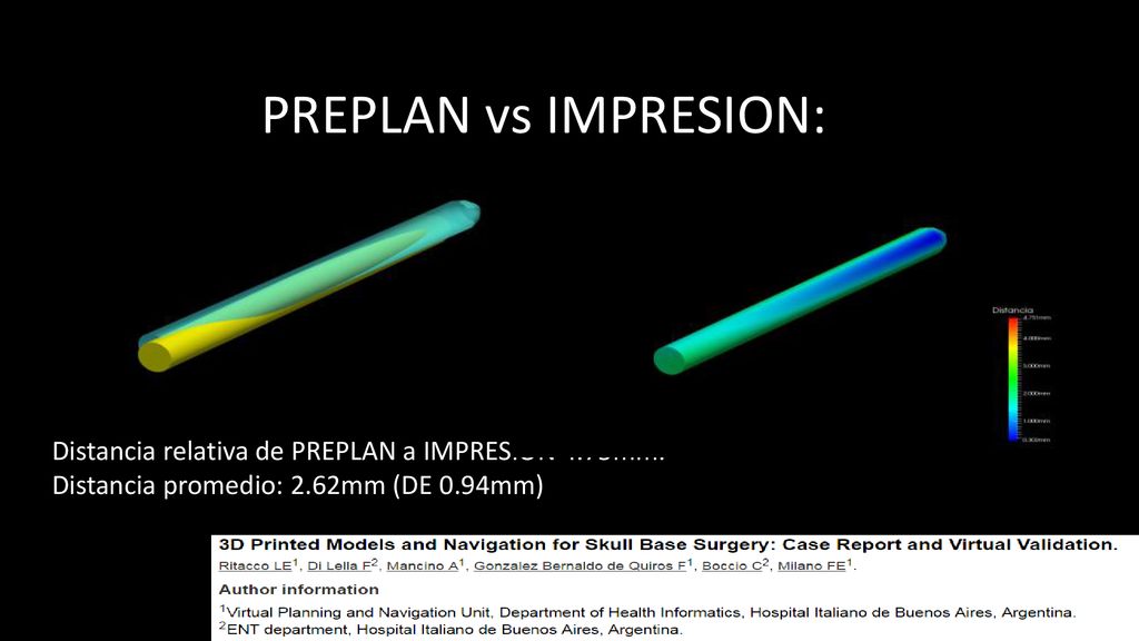 PREPLAN vs IMPRESION: Distancia relativa de PREPLAN a IMPRESIÓN 4.75mm. Distancia promedio: 2.62mm (DE 0.94mm)