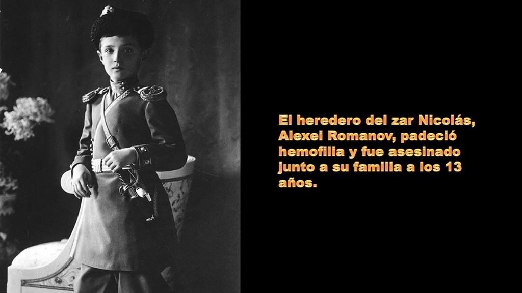 El heredero del zar Nicolás, Alexei Romanov, padeció hemofilia y fue asesinado junto a su familia a los 13 años.