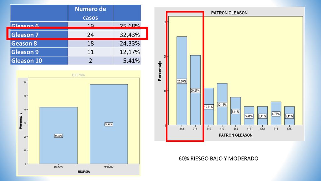 Numero de casos Gleason ,68% Gleason ,43% Geason 8 18