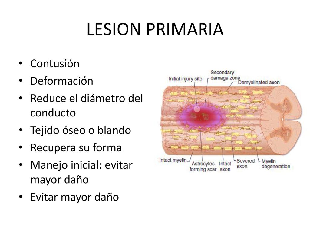 LESION PRIMARIA Contusión Deformación Reduce el diámetro del conducto
