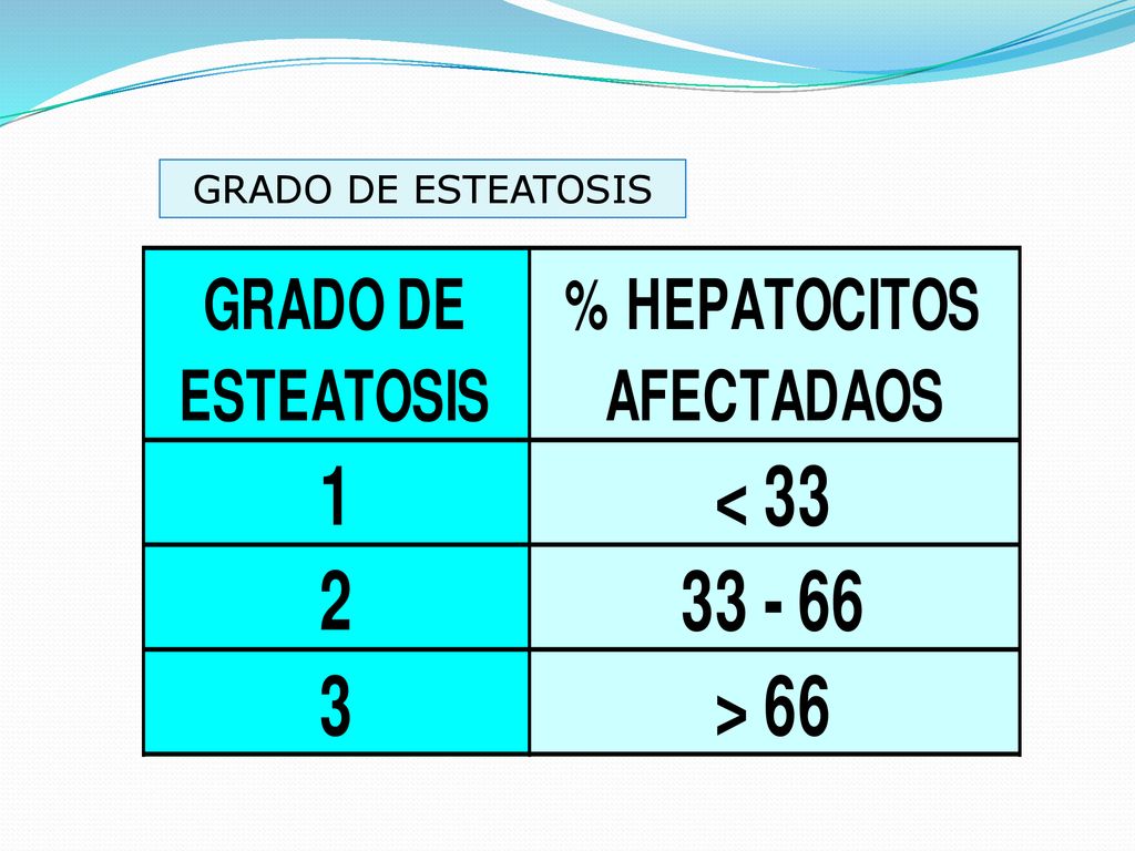 A table detailing the grading of steatosis, indicating three levels based on the percentage of affected hepatocytes: Grade 1 with less than 33%, Grade 2 with 33-66%, and Grade 3 with over 66%.