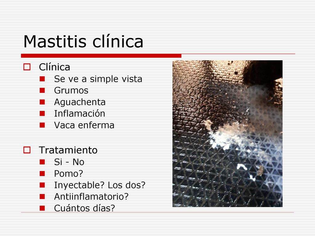 Mastitis clínica Clínica Tratamiento Se ve a simple vista Grumos