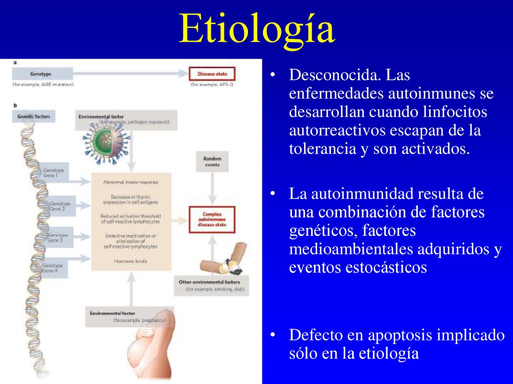Etiología Desconocida. Las enfermedades autoinmunes se desarrollan cuando linfocitos autorreactivos escapan de la tolerancia y son activados.