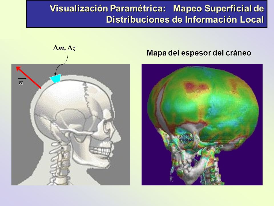 Visualización Paramétrica: Mapeo Superficial de Distribuciones de Información Local