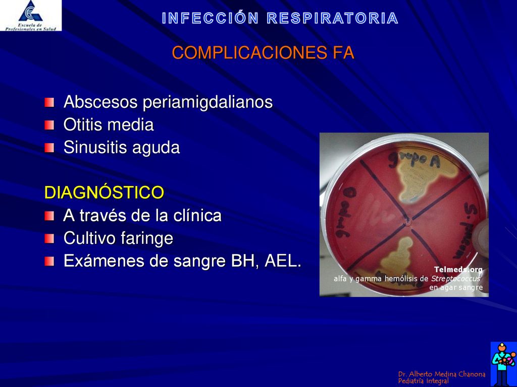 COMPLICACIONES FA Abscesos periamigdalianos. Otitis media. Sinusitis aguda. DIAGNÓSTICO. A través de la clínica.