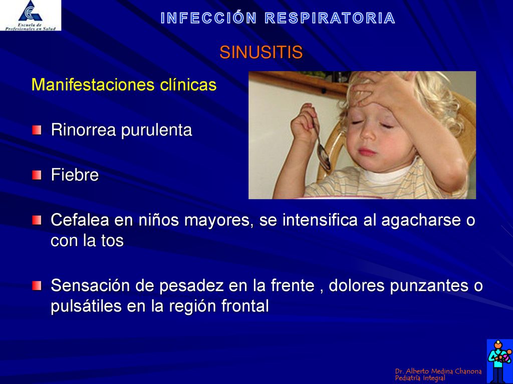 SINUSITIS Manifestaciones clínicas. Rinorrea purulenta. Fiebre. Cefalea en niños mayores, se intensifica al agacharse o con la tos.