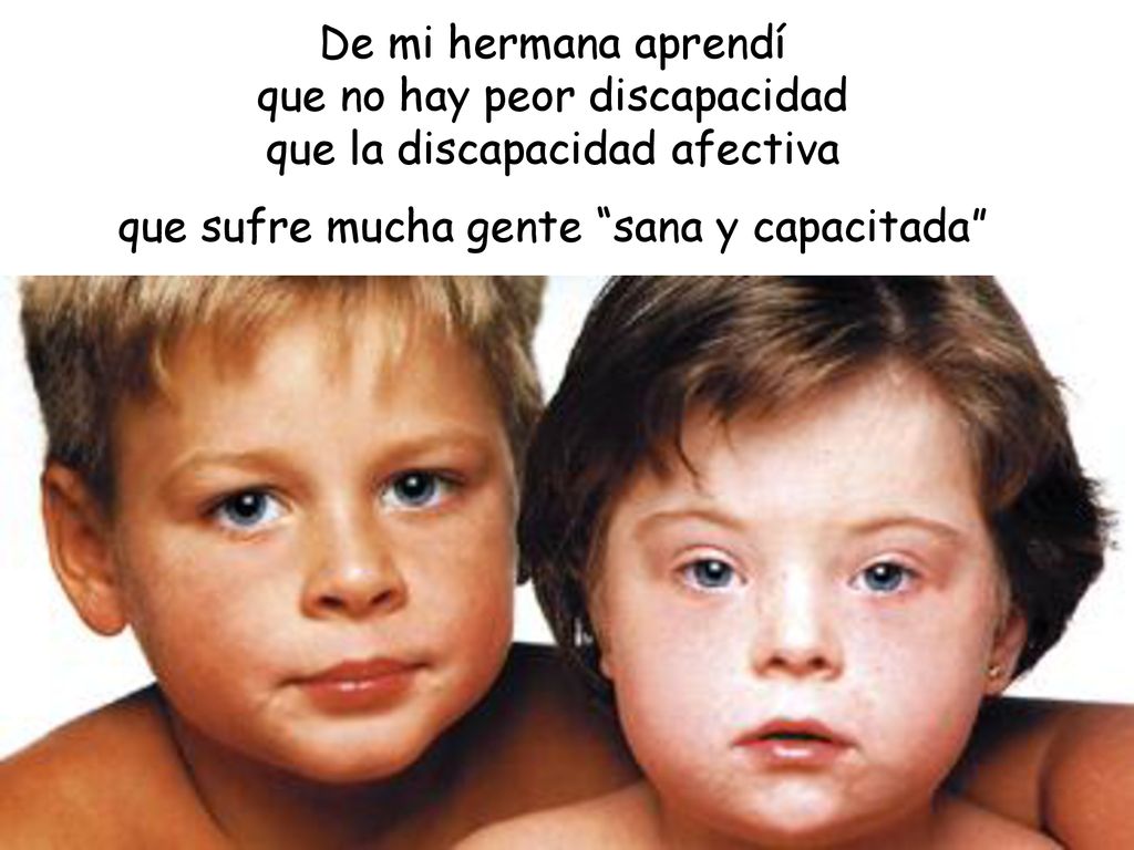 De mi hermana aprendí que no hay peor discapacidad que la discapacidad afectiva que sufre mucha gente sana y capacitada