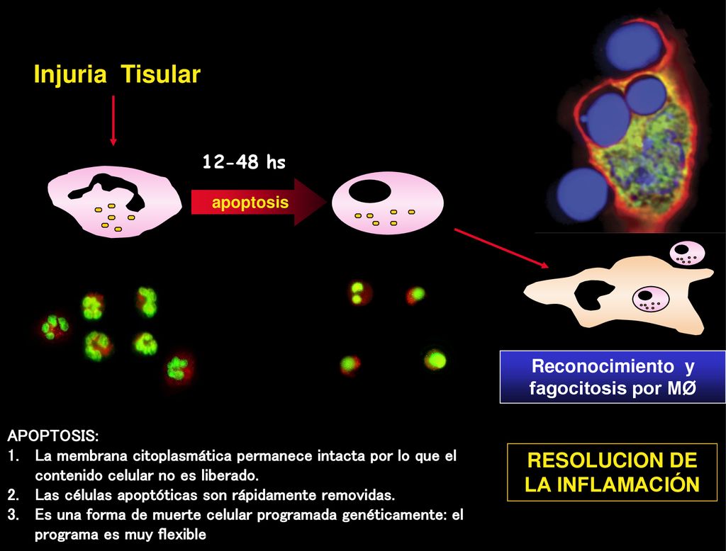 Reconocimiento y fagocitosis por MØ RESOLUCION DE LA INFLAMACIÓN