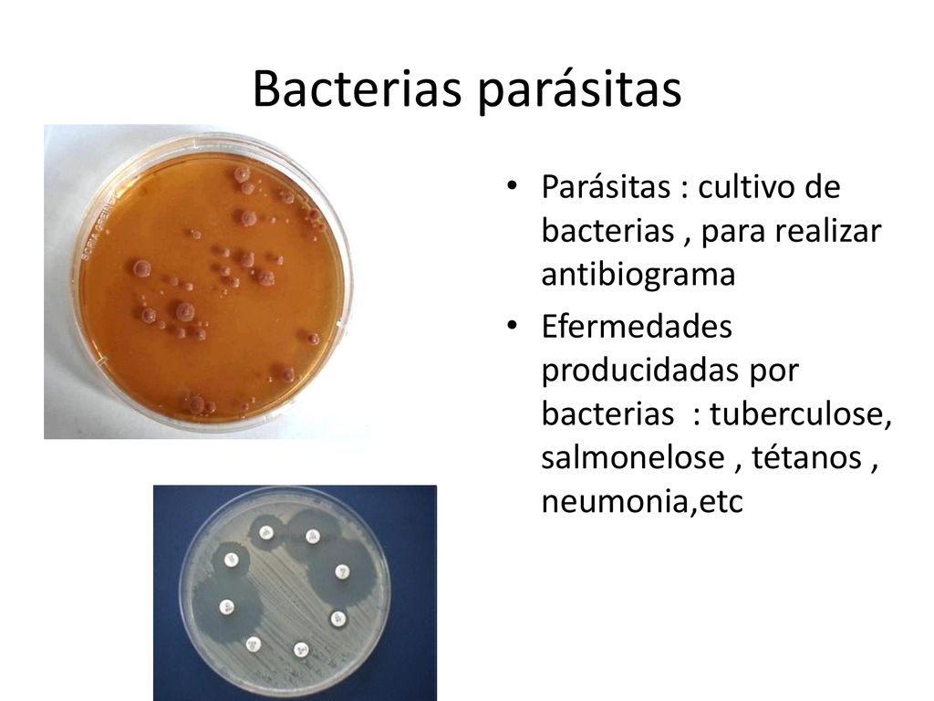 Bacterias parásitas Parásitas : cultivo de bacterias , para realizar antibiograma.