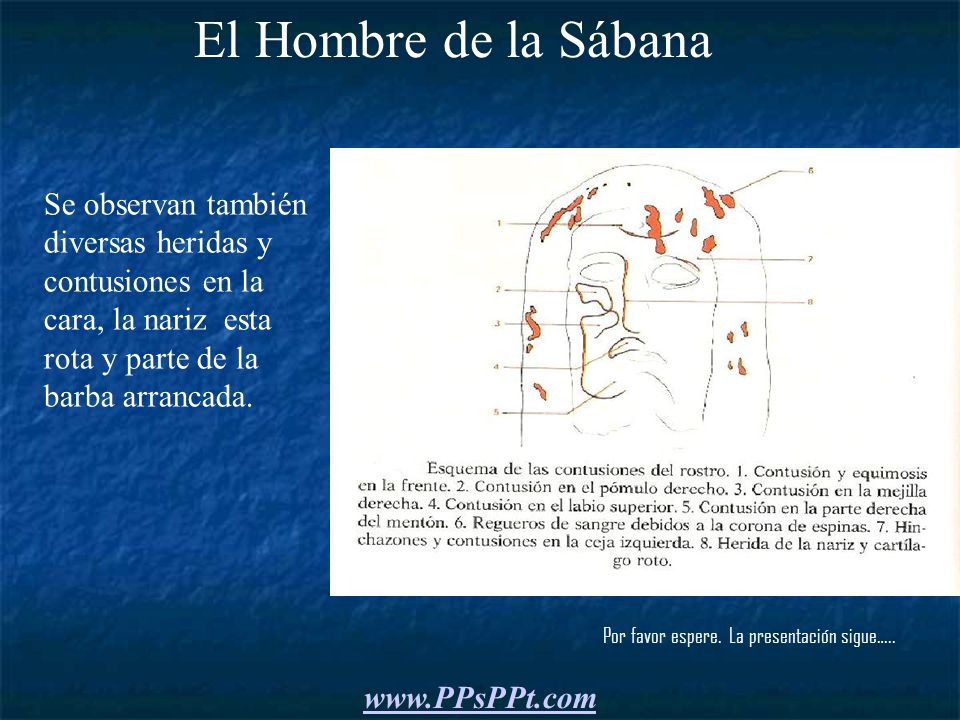 El Hombre de la Sábana Se observan también diversas heridas y contusiones en la cara, la nariz esta rota y parte de la barba arrancada.
