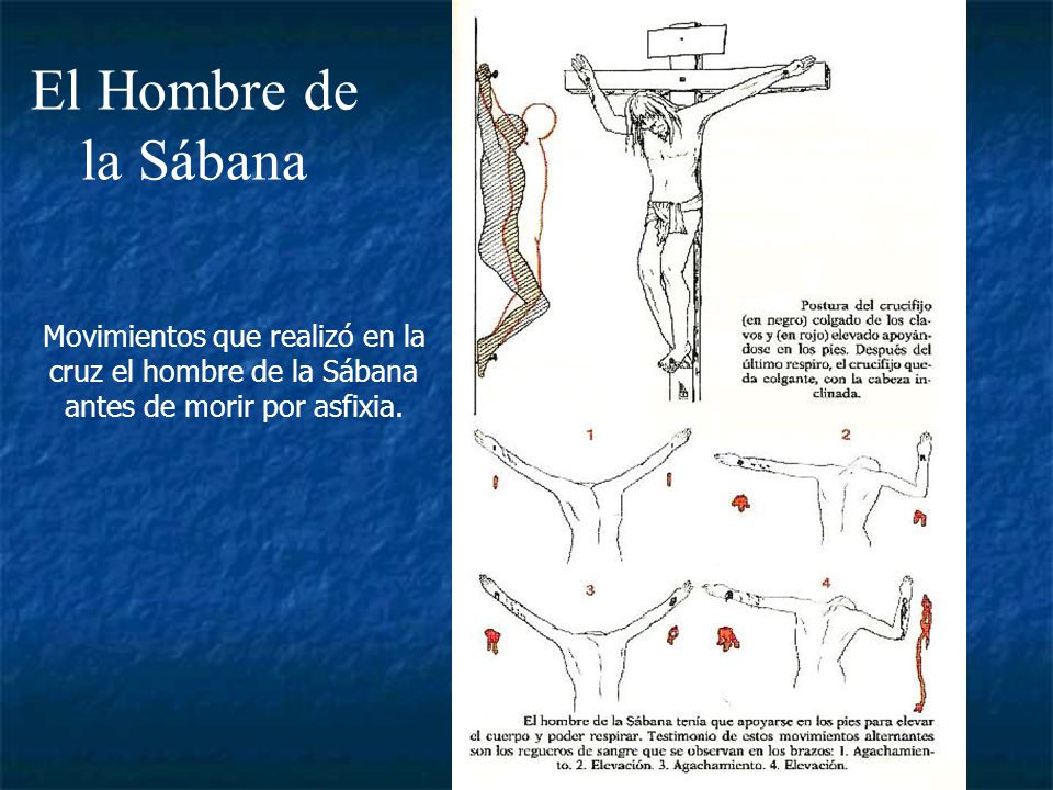 El Hombre de la Sábana Movimientos que realizó en la cruz el hombre de la Sábana antes de morir por asfixia.