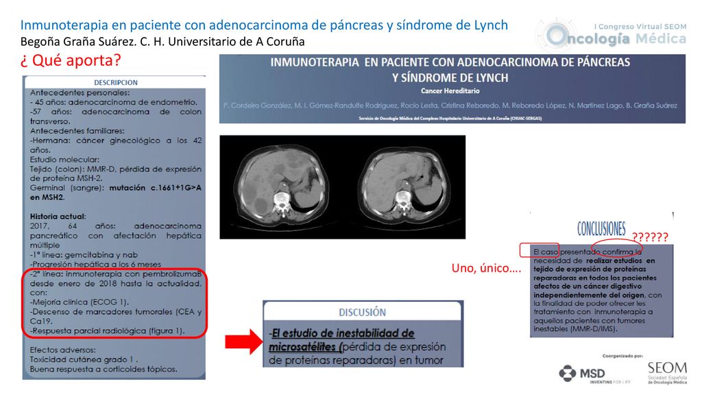 Inmunoterapia en paciente con adenocarcinoma de páncreas y síndrome de Lynch