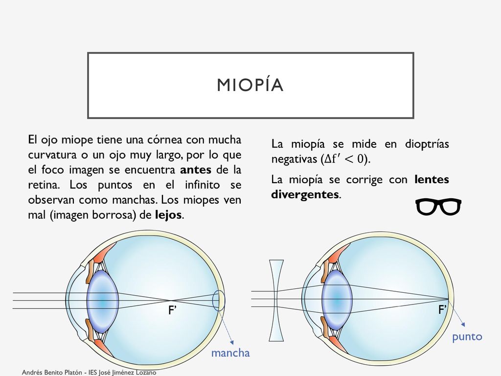 Miopía F’ F’ Andrés Benito Platón - IES José Jiménez Lozano