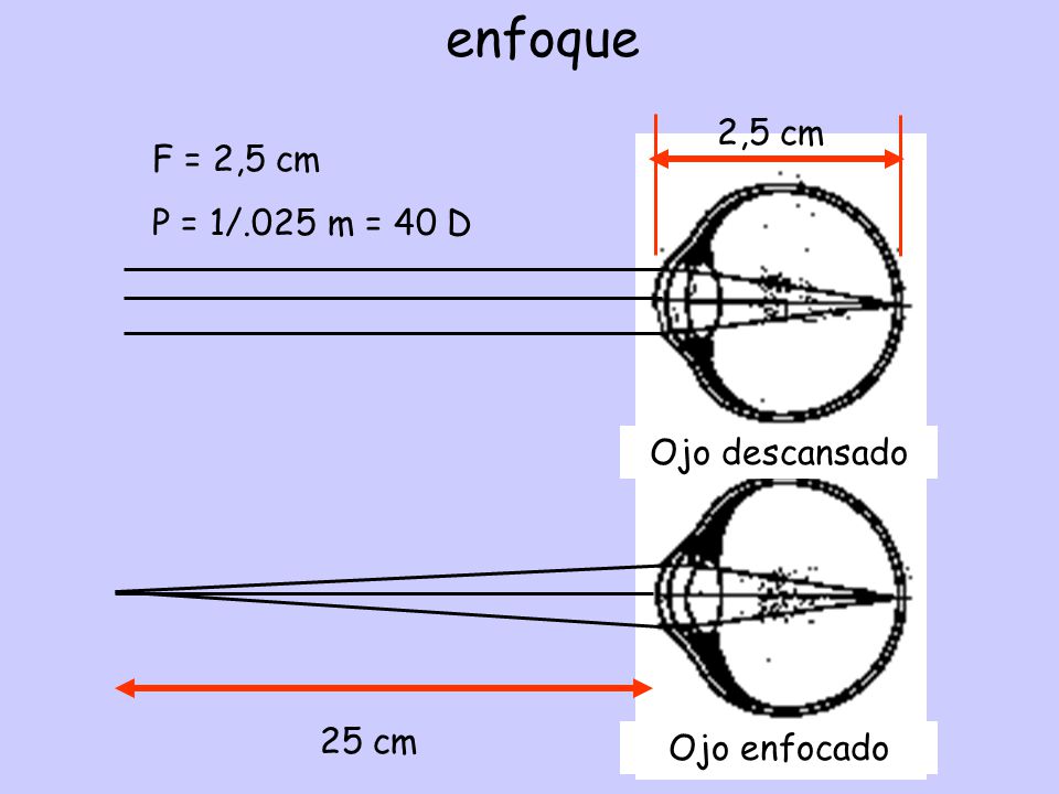 enfoque 2,5 cm F = 2,5 cm P = 1/.025 m = 40 D Ojo descansado 25 cm