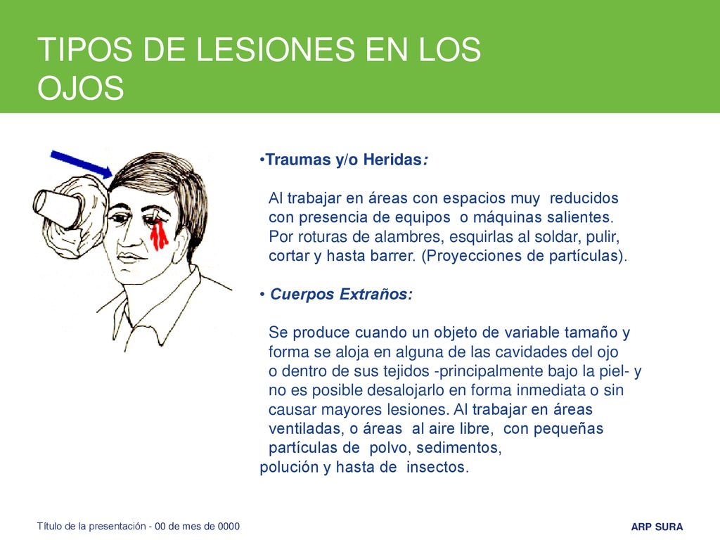 TIPOS DE LESIONES EN LOS OJOS