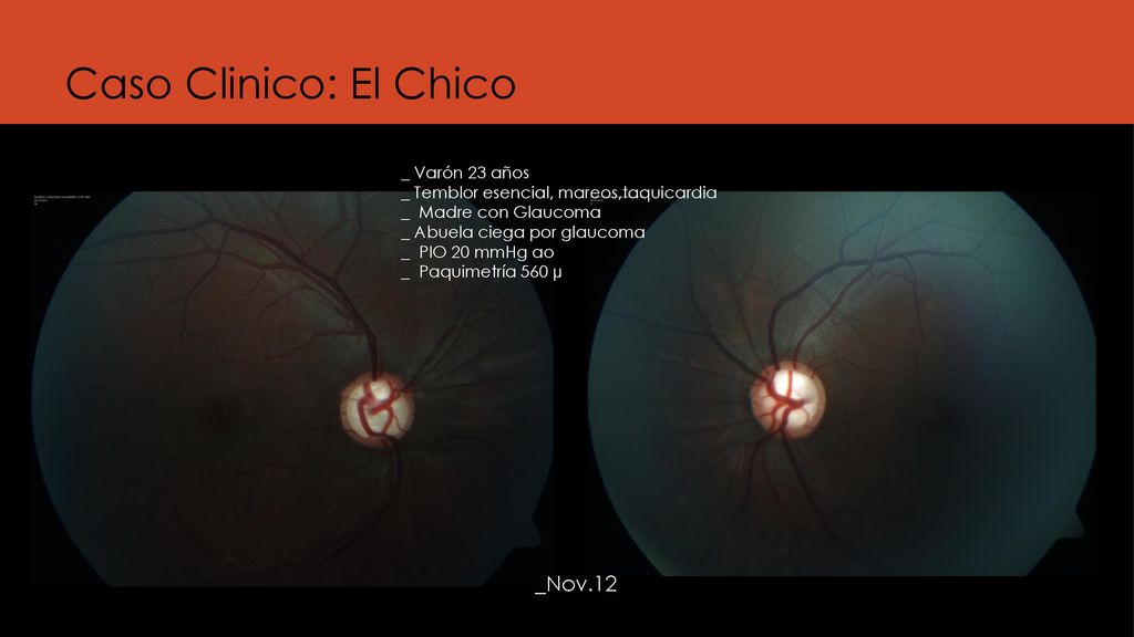 Caso Clinico: El Chico _Nov.12 _ Varón 23 años