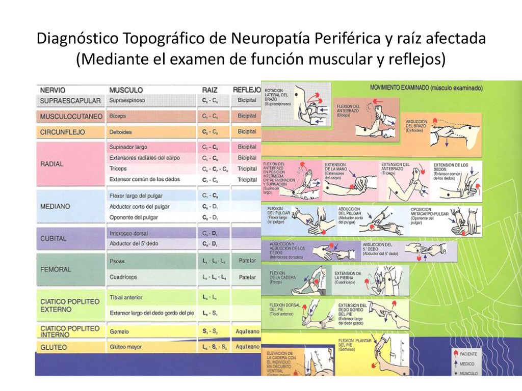 Diagnóstico Topográfico de Neuropatía Periférica y raíz afectada (Mediante el examen de función muscular y reflejos)