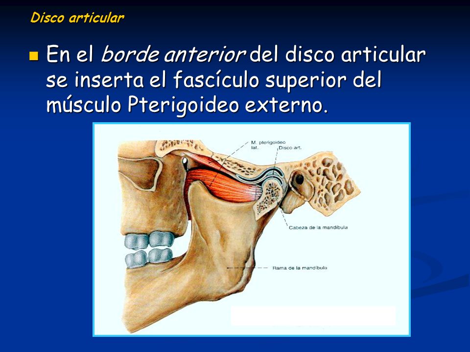 Disco articular En el borde anterior del disco articular se inserta el fascículo superior del músculo Pterigoideo externo.