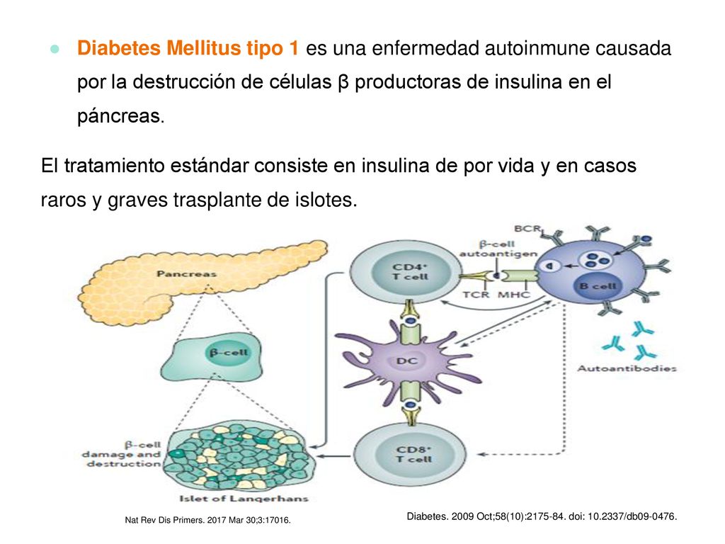 Diabetes Mellitus tipo 1 es una enfermedad autoinmune causada por la destrucción de células β productoras de insulina en el páncreas.