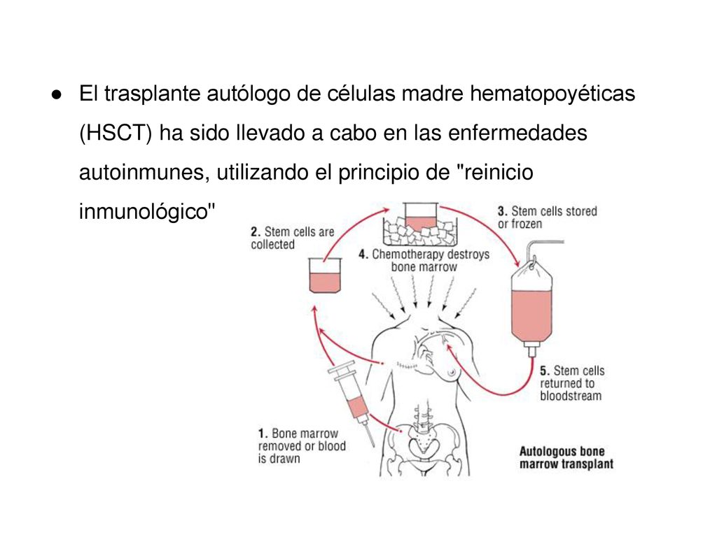 El trasplante autólogo de células madre hematopoyéticas (HSCT) ha sido llevado a cabo en las enfermedades autoinmunes, utilizando el principio de reinicio inmunológico