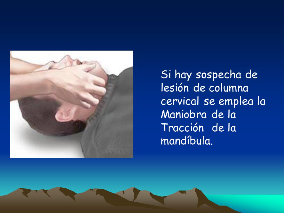 Si hay sospecha de lesión de columna cervical se emplea la Maniobra de la Tracción de la mandíbula.