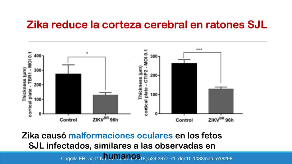 Zika reduce la corteza cerebral en ratones SJL