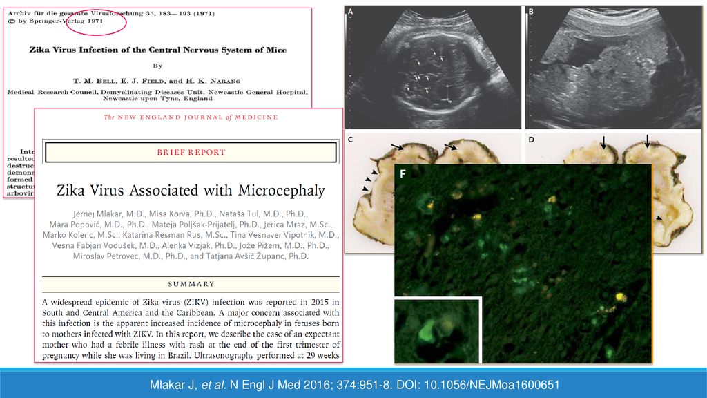 Mlakar J, et al. N Engl J Med 2016; 374: DOI: 10