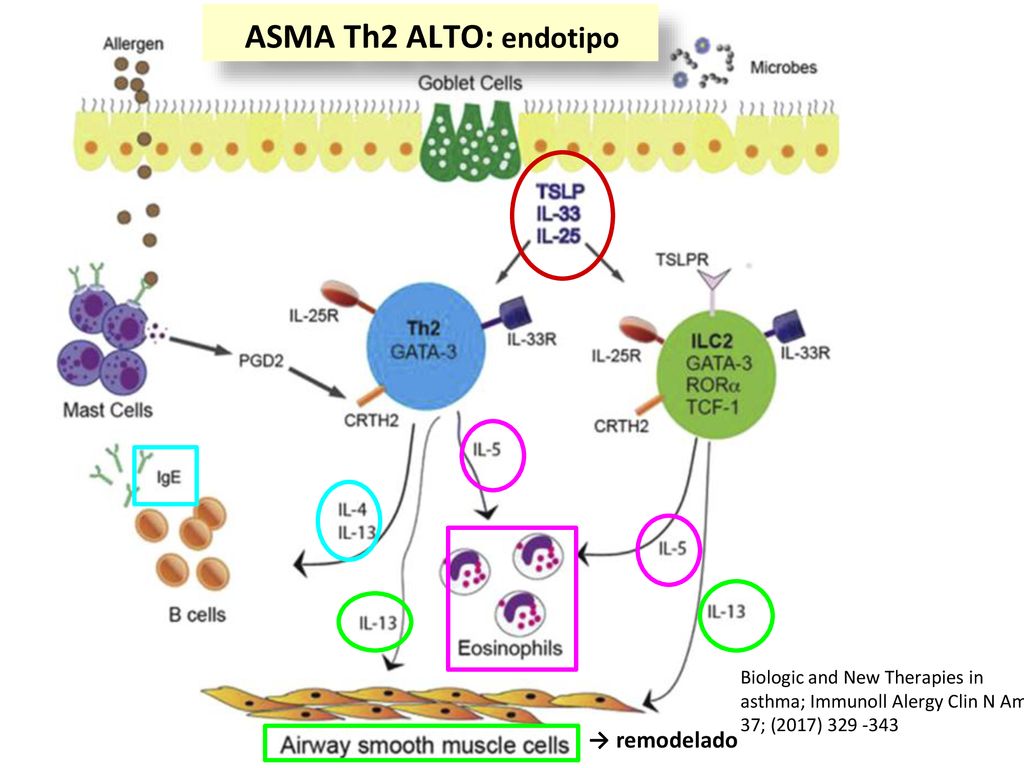ASMA Th2 ALTO: endotipo → remodelado