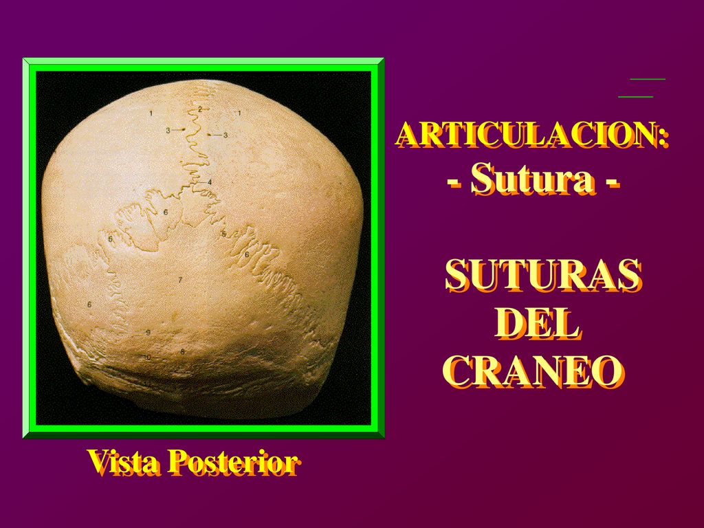 - - Sutura - Sutura - SUTURAS SUTURAS DEL DEL CRANEO CRANEO