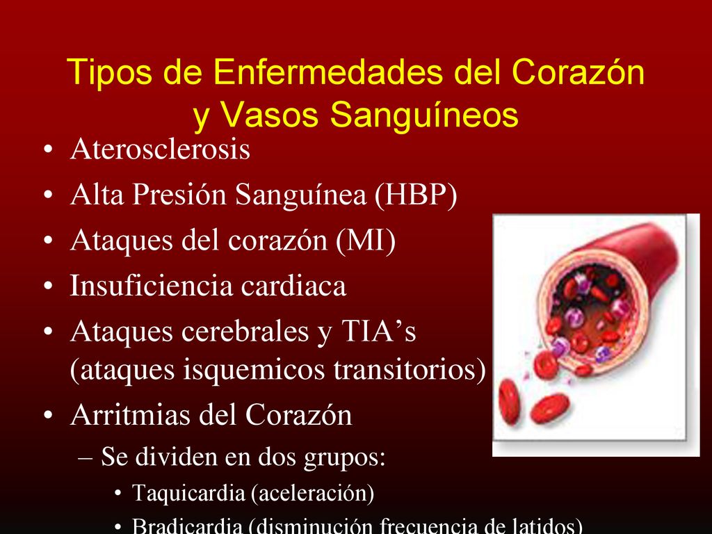 Tipos de Enfermedades del Corazón y Vasos Sanguíneos
