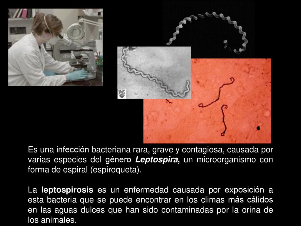 Es una infección bacteriana rara, grave y contagiosa, causada por varias especies del género Leptospira, un microorganismo con forma de espiral (espiroqueta).