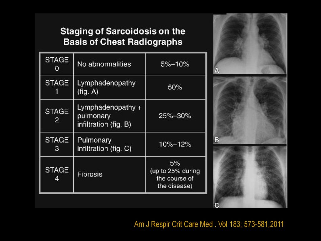 Am J Respir Crit Care Med . Vol 183; ,2011