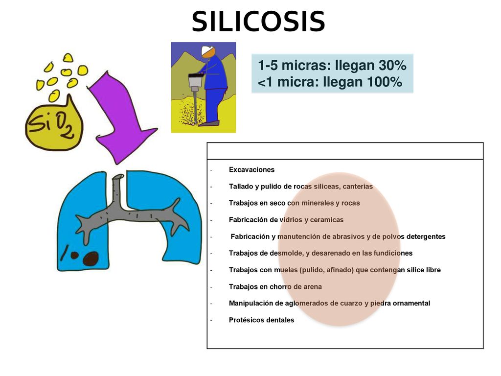 SILICOSIS 1-5 micras: llegan 30% <1 micra: llegan 100% Excavaciones
