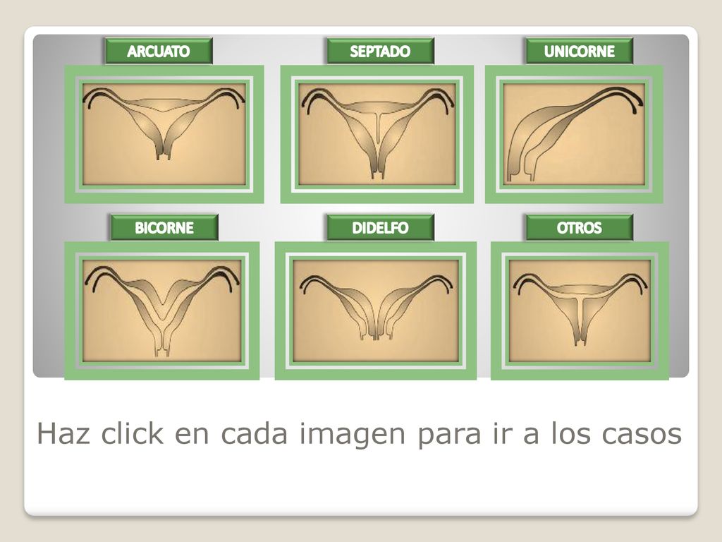 Haz click en cada imagen para ir a los casos