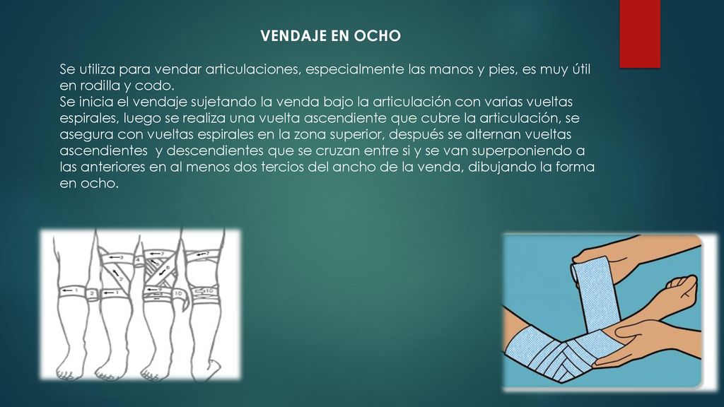 VENDAJE EN OCHO Se utiliza para vendar articulaciones, especialmente las manos y pies, es muy útil en rodilla y codo.
