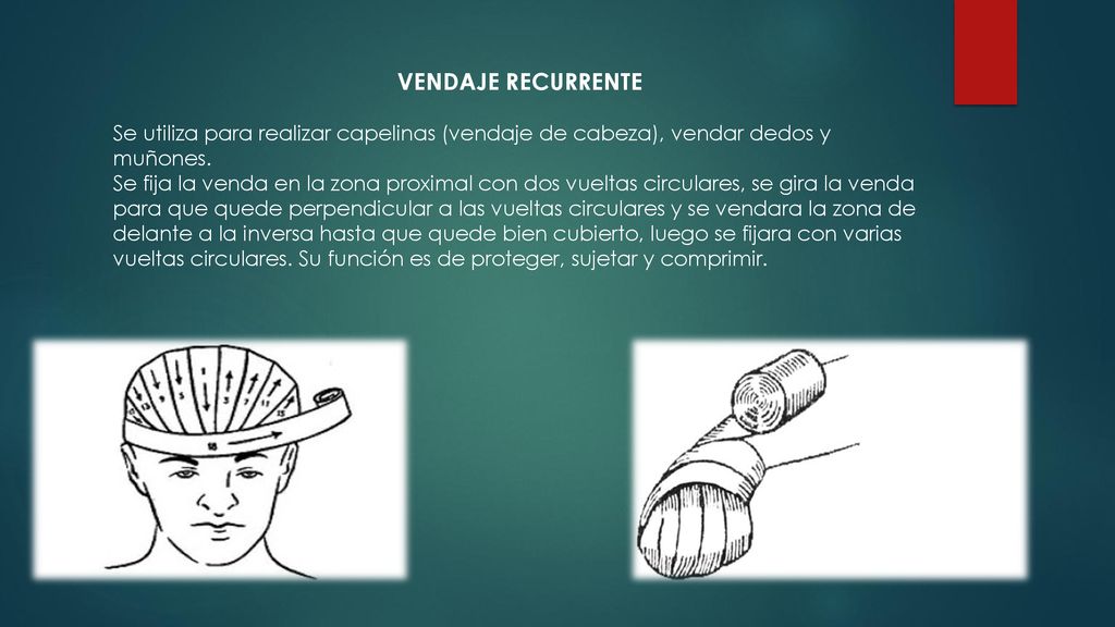 VENDAJE RECURRENTE Se utiliza para realizar capelinas (vendaje de cabeza), vendar dedos y muñones.
