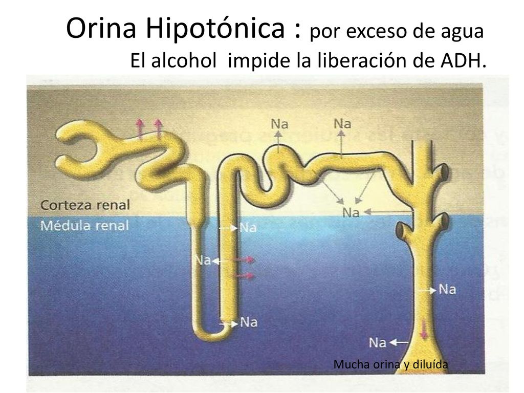 Orina Hipotónica : por exceso de agua El alcohol impide la liberación de ADH.