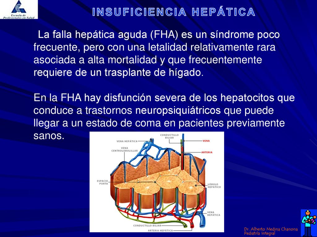 La falla hepática aguda (FHA) es un síndrome poco frecuente, pero con una letalidad relativamente rara asociada a alta mortalidad y que frecuentemente requiere de un trasplante de hígado.
