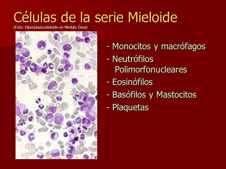 Células de la serie Mieloide (Foto: Hiperplasia mieloide en Medula Ósea)