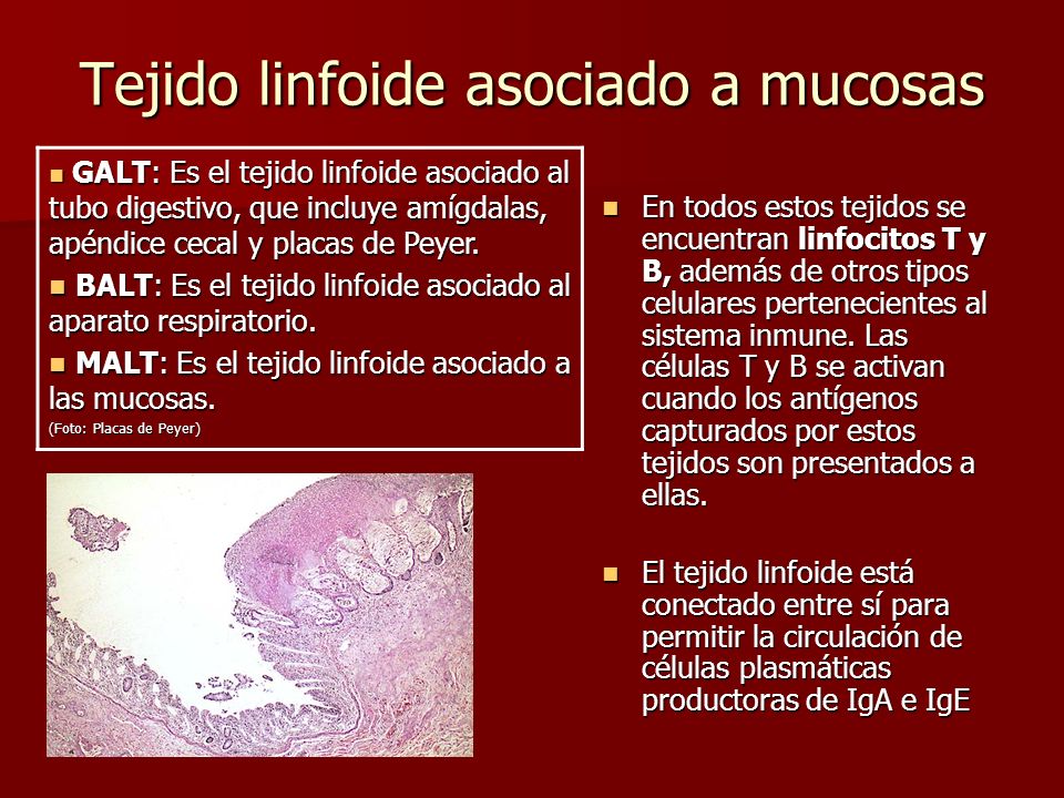 Tejido linfoide asociado a mucosas