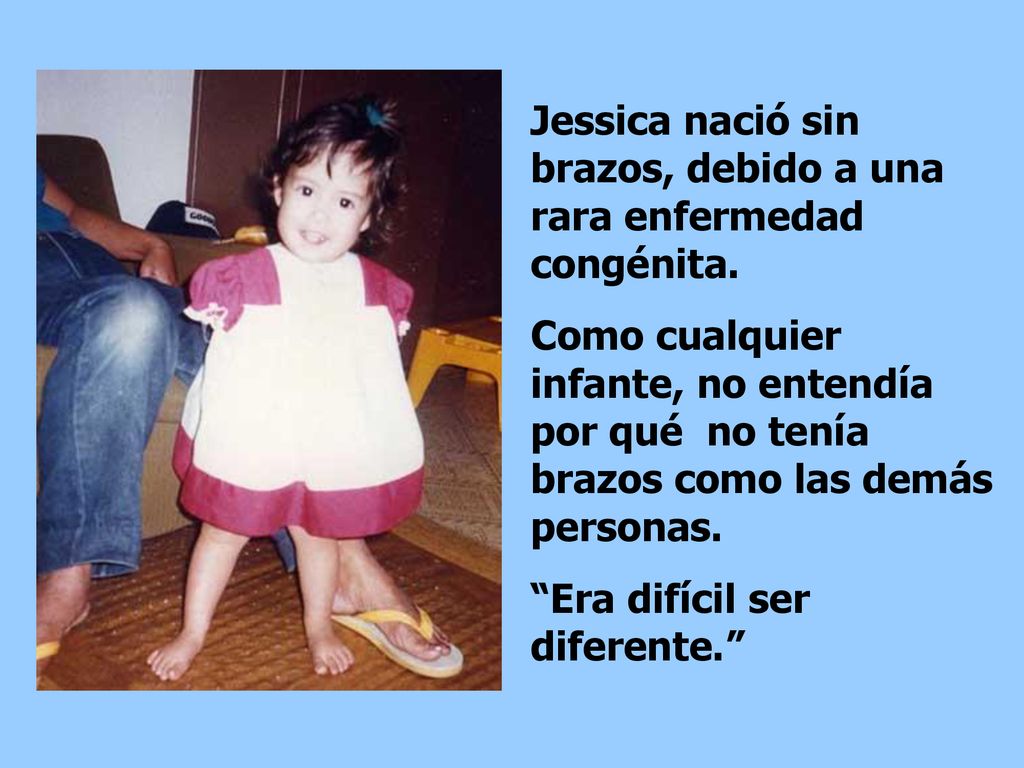 Jessica nació sin brazos, debido a una rara enfermedad congénita.