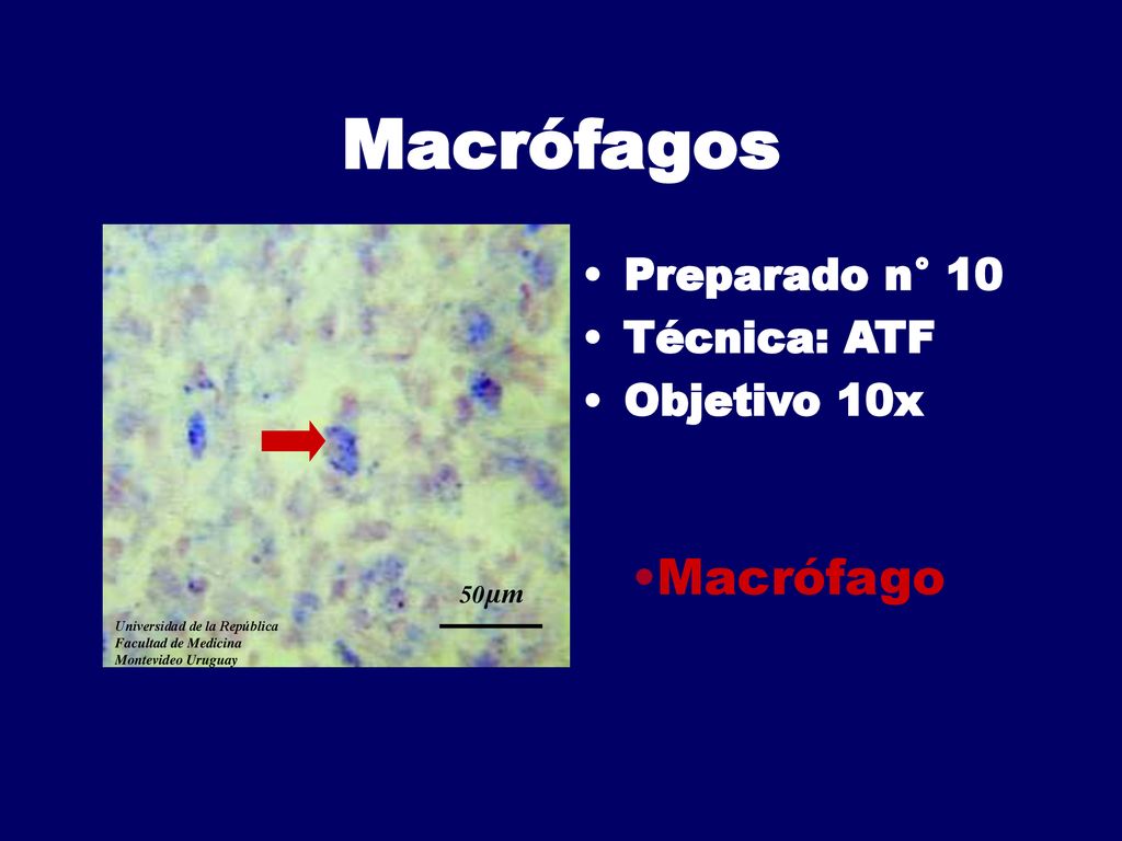 Macrófagos Macrófago Preparado n° 10 Técnica: ATF Objetivo 10x 50µm