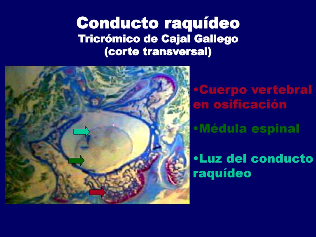 Conducto raquídeo Tricrómico de Cajal Gallego (corte transversal)