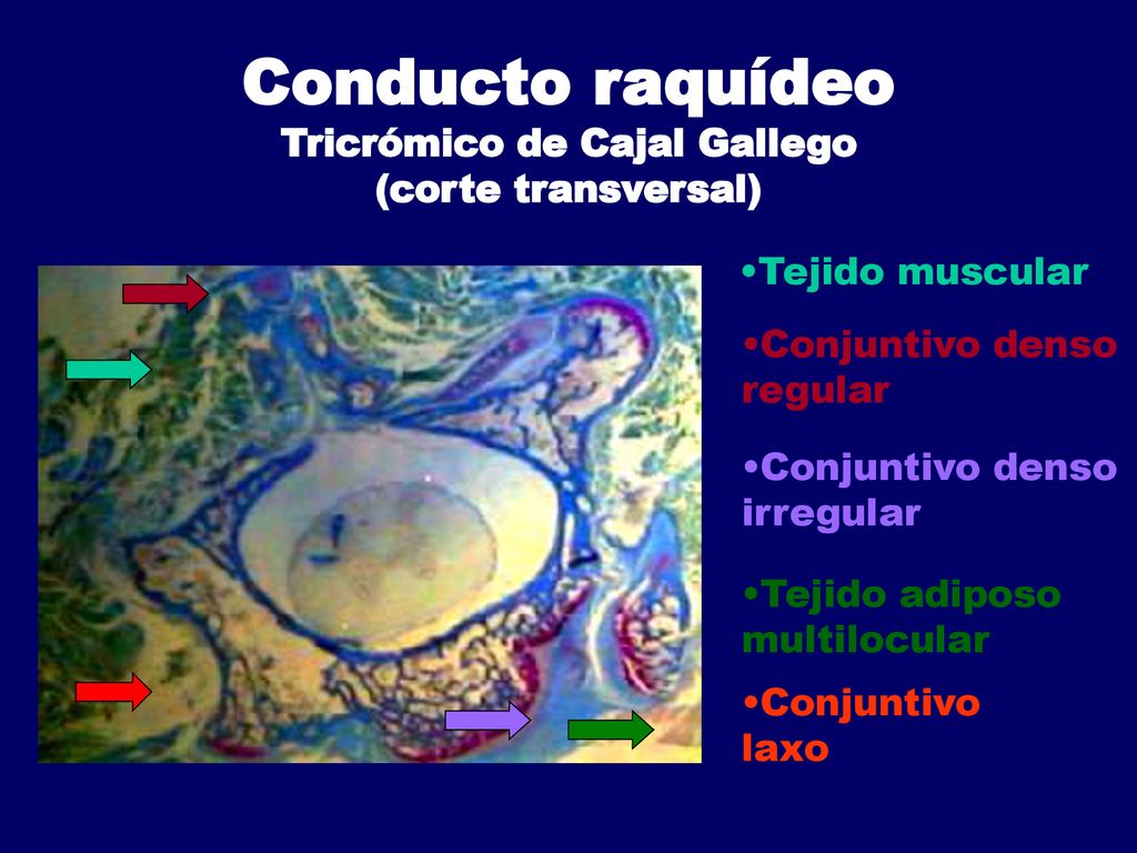 Conducto raquídeo Tricrómico de Cajal Gallego (corte transversal)