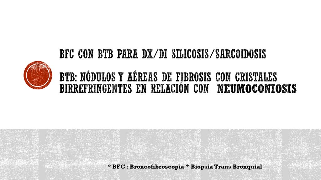 BFC con BTB para Dx/Di silicosis/sarcoidosis BTB: nódulos y aéreas de fibrosis con cristales birrefringentes en relación con Neumoconiosis