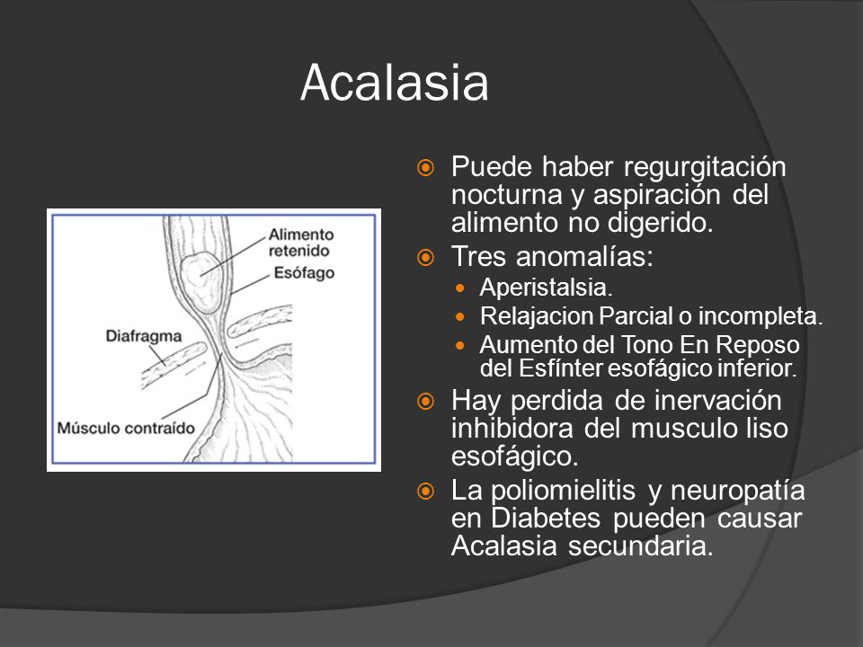 Acalasia Puede haber regurgitación nocturna y aspiración del alimento no digerido. Tres anomalías: