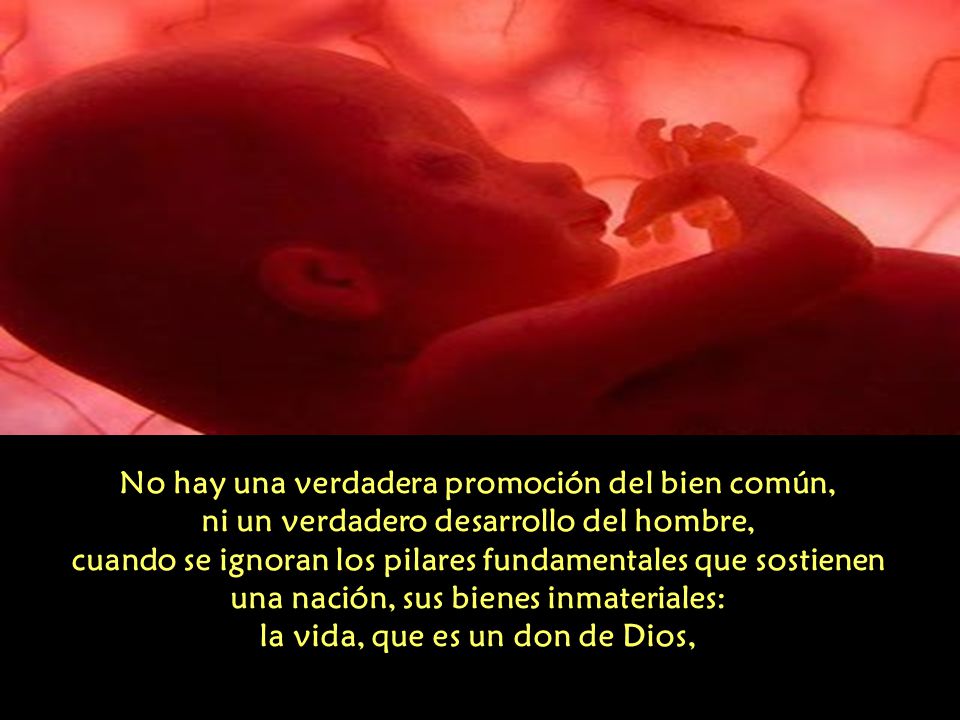 No hay una verdadera promoción del bien común, ni un verdadero desarrollo del hombre, cuando se ignoran los pilares fundamentales que sostienen una nación, sus bienes inmateriales: la vida, que es un don de Dios,