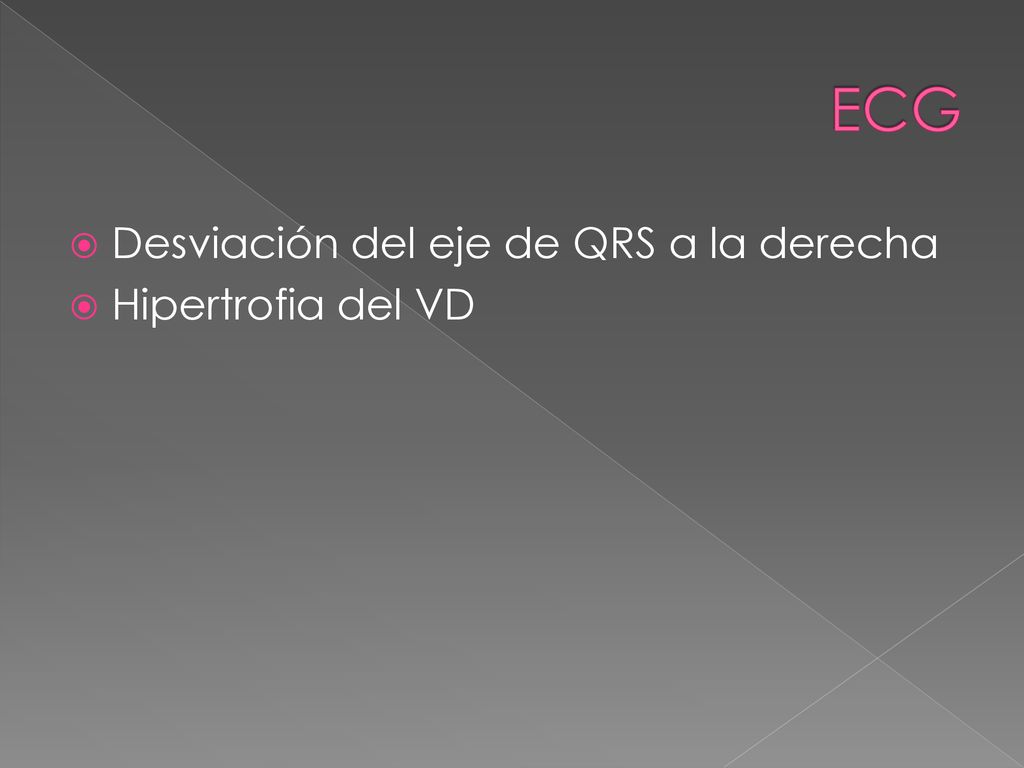 ECG Desviación del eje de QRS a la derecha Hipertrofia del VD