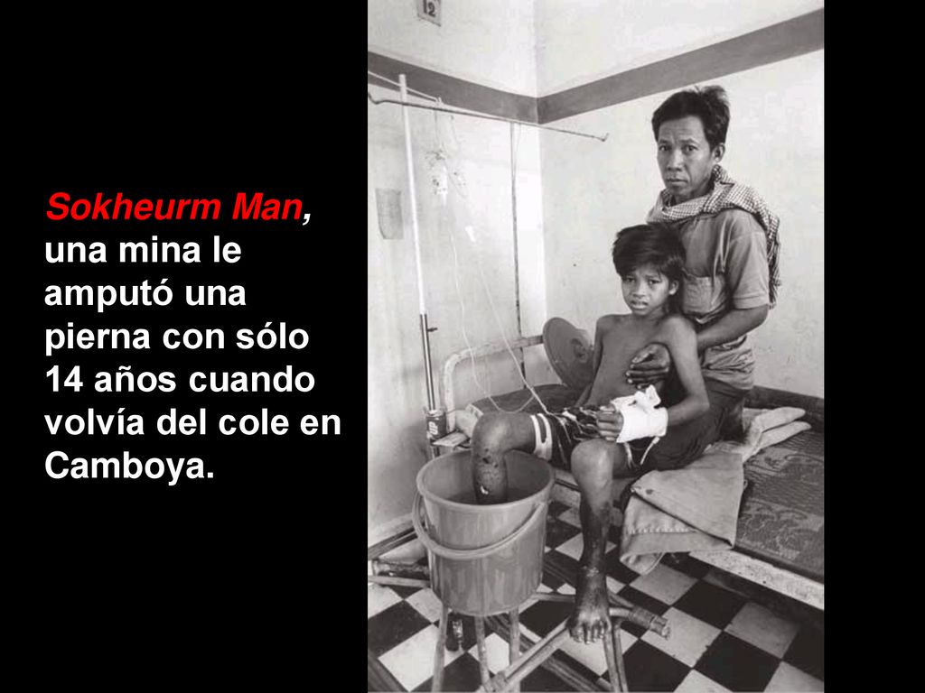 Sokheurm Man, una mina le amputó una pierna con sólo 14 años cuando volvía del cole en Camboya.